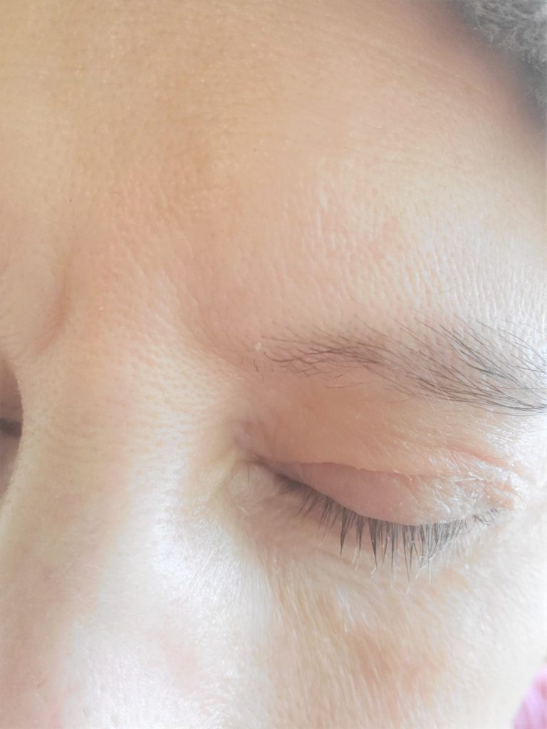 my right eyebrow and lashes